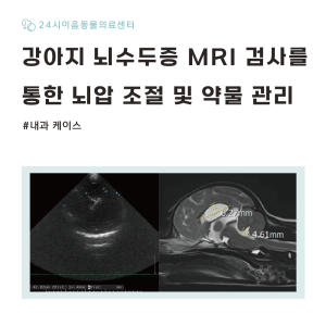 [케이스 리포트] 신경 증상을 유발한 뇌수두증 증례: 내과적 뇌압 조절 …