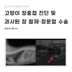 [케이스 리포트] 급성 복통을 유발한 장중첩 증례: 장중첩 환납 및 장문…