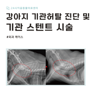 [케이스 리포트] 호흡곤란을 유발한 기관허탈 증례: 기관 스텐트 시술 적…